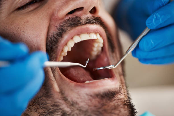 Best Dentist for Tooth Abscess  in El Rancho, NM